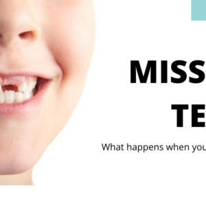 Why You Shouldn’t Ignore Missing Teeth