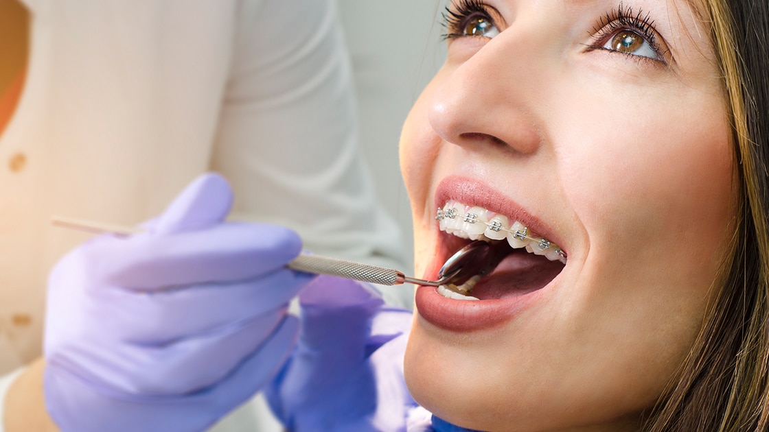 Orthodontic Treatment in Magarpatta