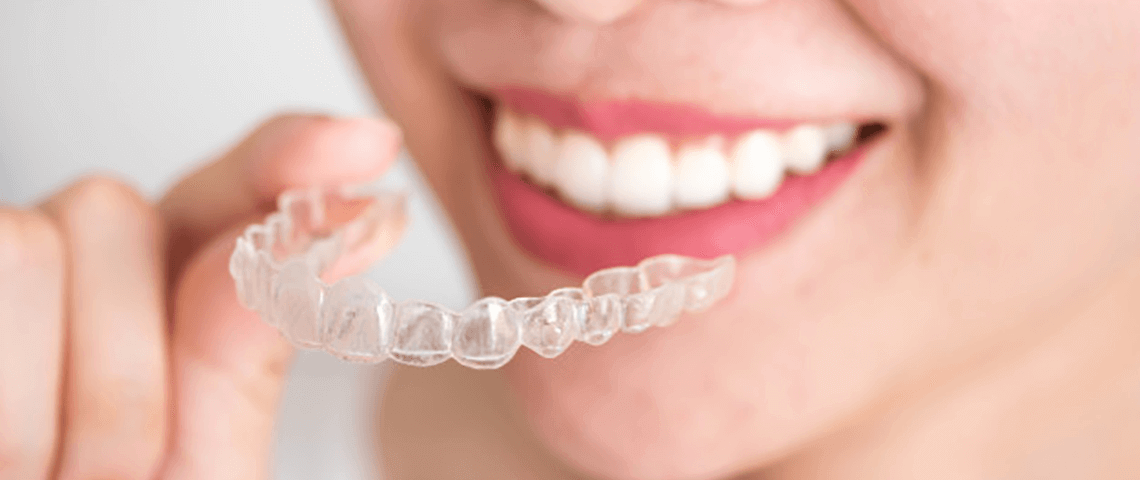 Braces and invisalign Treatment in Magarpatta | The Smile Studio