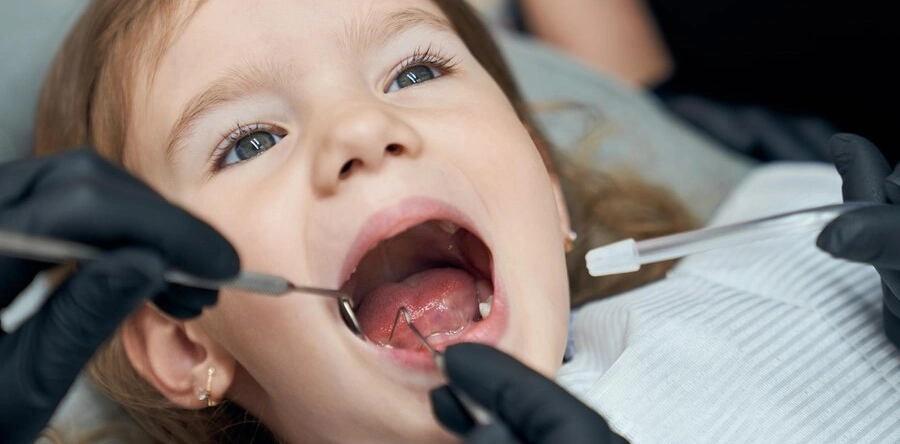 Preventing Childhood Cavities: Tips and Tricks for Parents